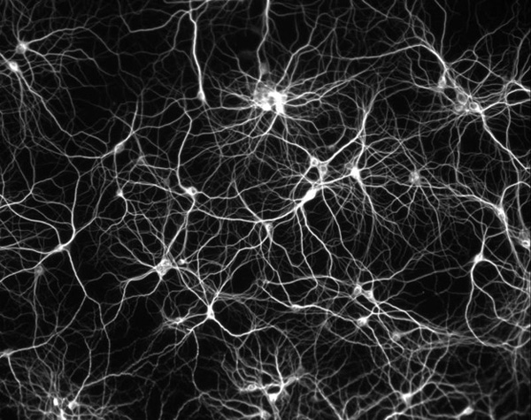 world-microscopic-wonders-brain-neurons
